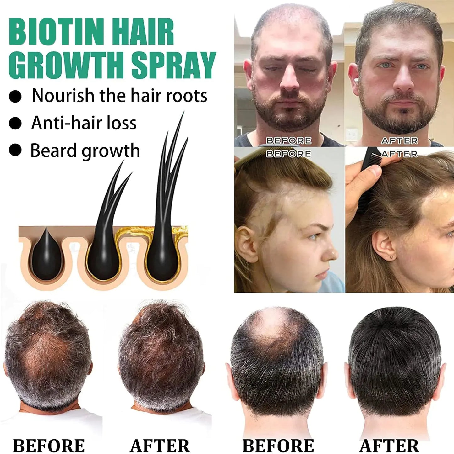 Herbal Hair Growth Spray for Strong Roots and Nourishment