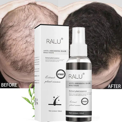 Herbal Hair Growth Spray for Strong Roots and Nourishment