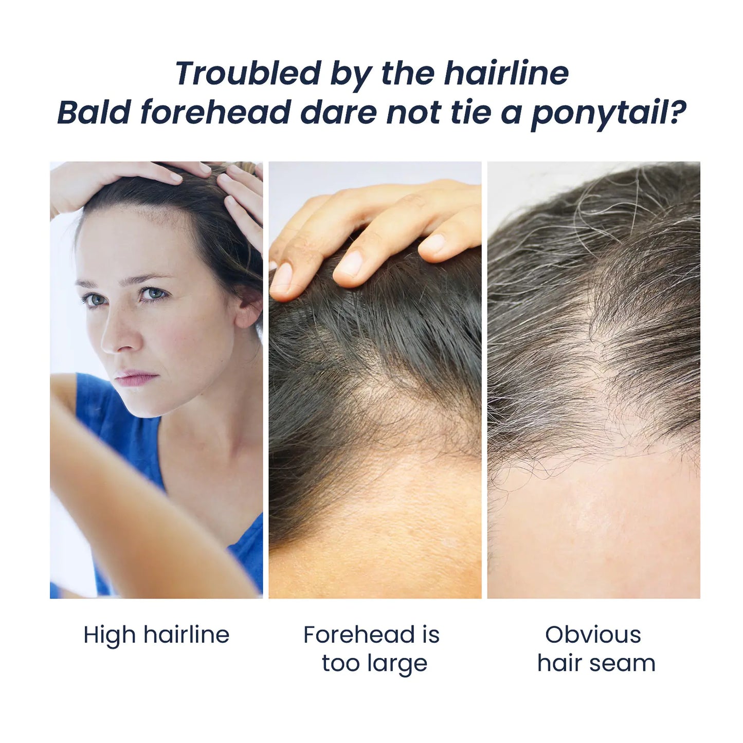 EELHOE Hair Thickening Fiber Powder for Roots and Volume